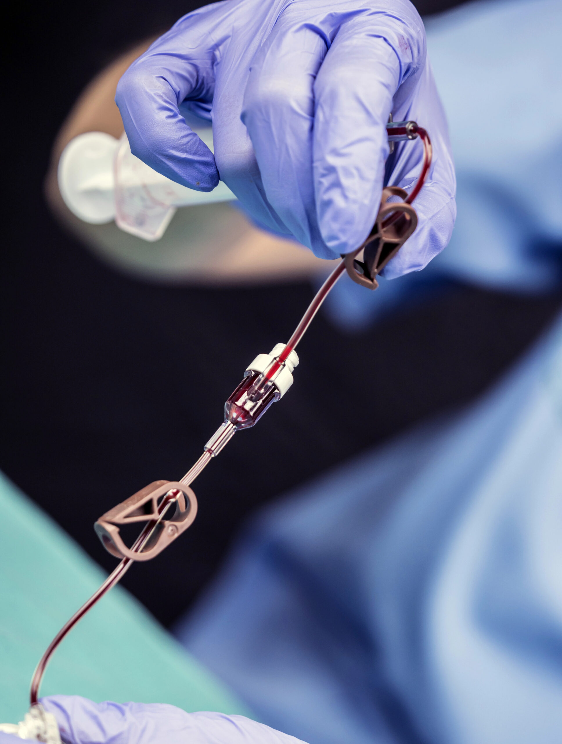 Nurse prepares Venous catheters of Long Duration in a hospital, Accessing Indwelling Central Venous Lines
